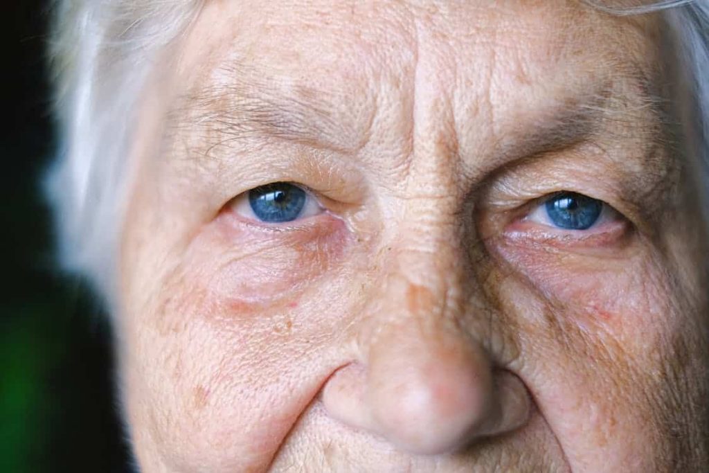 non surgical facelift treatment hifu treatment singapore