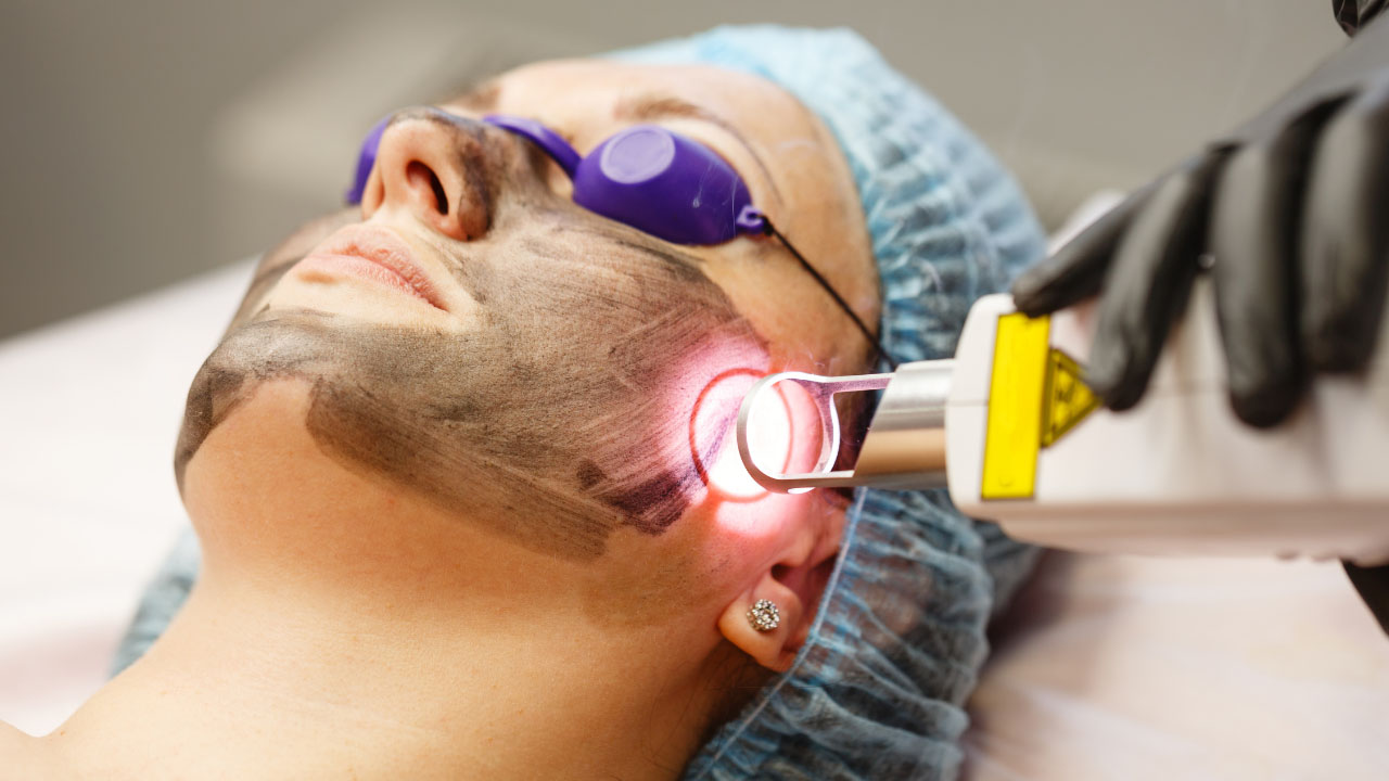 a woman undergoing pigmentation laser treatments