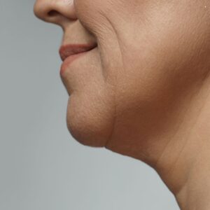 focused ultrasound energy treatment for jaw