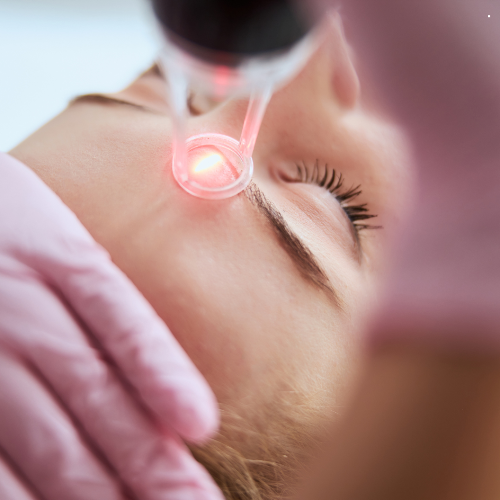 pico laser treatment vs q switch laser treatment